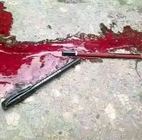 Dark_cloud22's tweet photo. Can you dare to see this?
Is there any difference between our blood and yours?
@hrw @UNOCHA @UNHumanRights @UN @USAID @JoeBiden @JustinTrudeau @BorisJohnson 
#LetUsLive https://t.co/WwpJTBIi0i