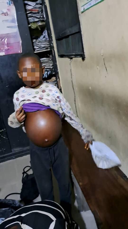 BenHundeyin's tweet photo. These men get minors from villages, get a medical doctor to allegedly inject them with substances that make their stomach swell outrageously, and parade them in road traffic as critically sick, to get alms from motorists. Investigation is ongoing. 1/2 https://t.co/il8Rofte8e