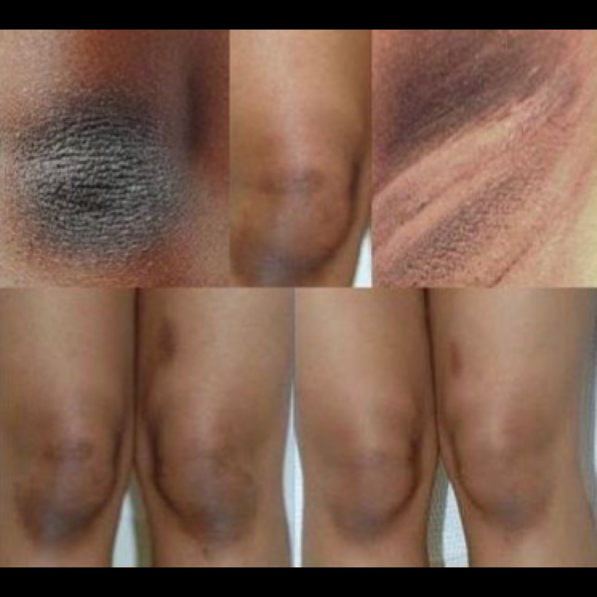 Cream Lipatan Terbaik untuk Mencerahkan✨

A Thread