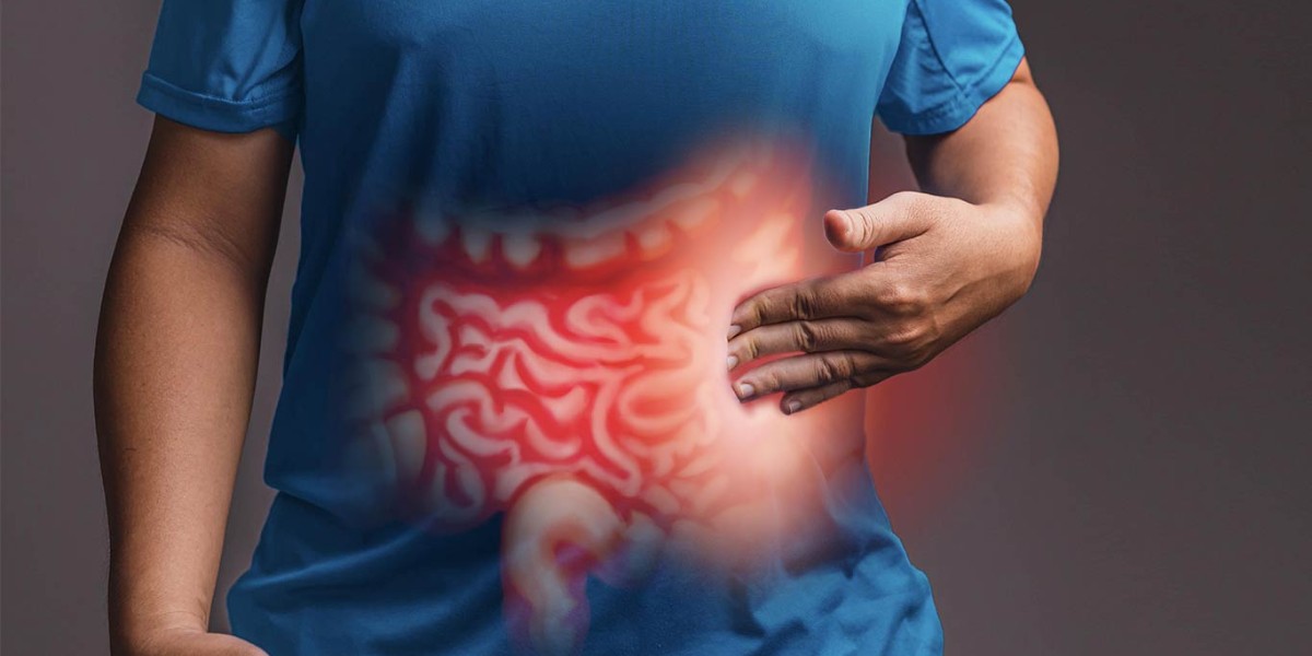 Gastroenterology Advisor (@gastro_advisor) on Twitter photo Patients with inflammatory bowel disease have an increased risk for incident and premature acute arterial events. Study in <a href="/AGA_CGH/">CGH</a>. #gastroenterology #GItwitter <a href="/QuazimAlayo/">Quazim Alayo</a> <a href="/EdwardLoftus2/">Edward Loftus</a> <a href="/AndresYarur/">Andres Yarur</a> <a href="/dmalvara3/">David Alvarado</a> <a href="/CiorbaGI/">Matthew Ciorba MD</a> @p_deepakibdmd
fal.cn/3smeq Patients with inflammatory bowel disease have an increased risk for incident and premature acute arterial events. Study in <a href="/AGA_CGH/">CGH</a>. #gastroenterology #GItwitter <a href="/QuazimAlayo/">Quazim Alayo</a> <a href="/EdwardLoftus2/">Edward Loftus</a> <a href="/AndresYarur/">Andres Yarur</a> <a href="/dmalvara3/">David Alvarado</a> <a href="/CiorbaGI/">Matthew Ciorba MD</a> @p_deepakibdmd
fal.cn/3smeq