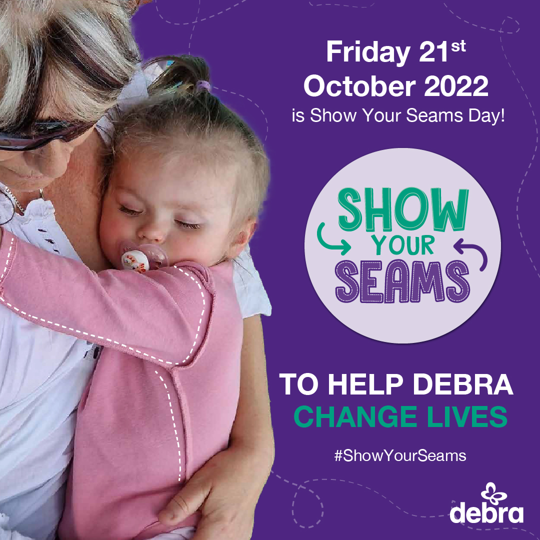 CharityDEBRA's tweet photo. 20 days to go until #ShowYourSeams day, will you be taking part? π
Wear your clothes inside out and bring in a donation to help improve quality of life for people living with EB.
Get involved: https://t.co/rsCx5auQhW
#ShowYourSeamsDay #EB #EpidermolysisBullosa #LifeWithEB https://t.co/OgTCuUYQAR
