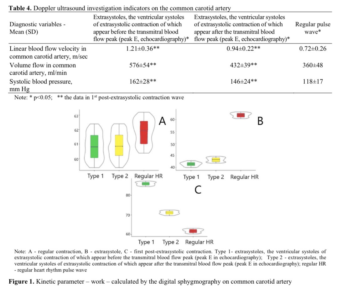 GiuseppeGalati_'s tweet photo. Our study on #Cryptogenic #Stroke in the context of pandemic-related stress
A focus on hemodynamics in the interplay between #cardiology &amp; #psychiatry
Thanks to Prof #Germanova et al 🤝 
@DrRajivsankar @DrMarthaGulati @mmamas1973 @gbiondizoccai @iamritu 
https://t.co/zKisZlZ9La https://t.co/sw5Z6y5OQh