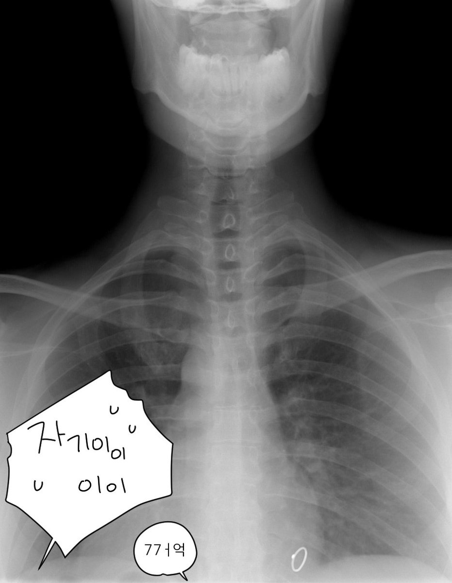 maroronnn's tweet image. 1001