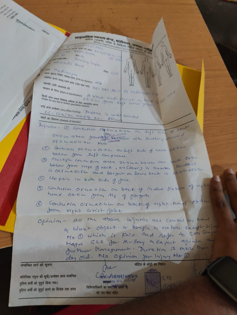 SAURABHBABUGUP3's tweet photo. I was beaten so badly that I was hardly able  to walk. I called and informed this incident  to the nearest Police Station Modinagar, Ghaziabad. Police came and took me to the police for the medical examine. And lodged my complaint. https://t.co/LmVTXRJBW0