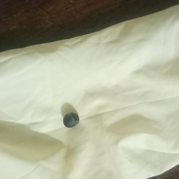 MercyKiprono80's tweet photo. #RotInMTRH #JusticeForAnnitaJepkorir 
Late Annita was chocked by a flower seed and rushed to Mediheal then referred to Moi Teaching &amp; Referral Hospital,Eldoret.The CT Scan showed that the seed was lodged in the RIGHT BRONCHI @DCI_Kenya @MOH_Kenya @thekhrc @EACCKenya @KituoSheria https://t.co/b3a9Jzv86p