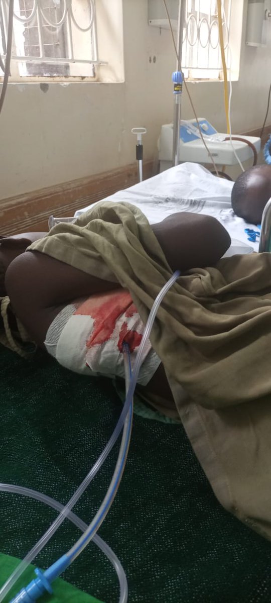 MercyKiprono80's tweet photo. She was attended by two 2nd year COSECSA students who were claiming to be consultants(Alfred Wanyonyi &amp; Ernest Nshom-Cameroonian).They did multiple operations and failed to remove the seed but instead removed 2 incisor teeth from the upper jaw #RotInMTRH #JusticeForAnnitaJepkorir https://t.co/w30MjFjj7v