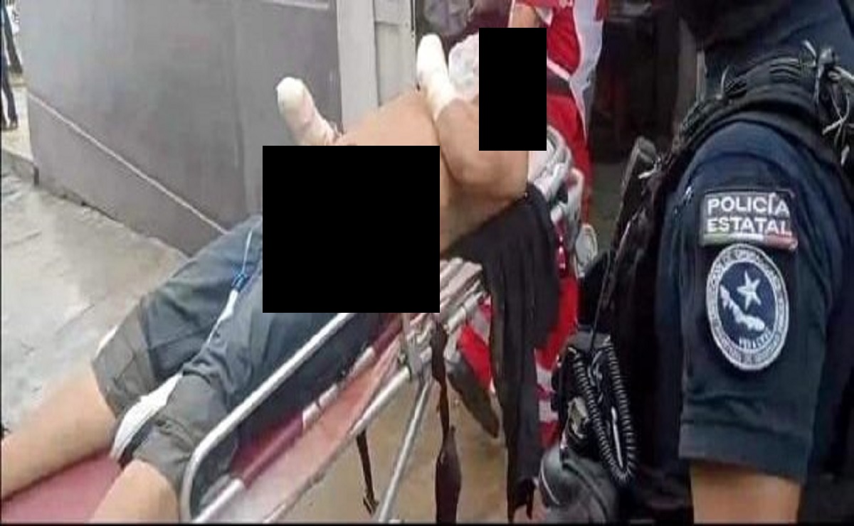 PueblaenLinea's tweet photo. Comando armado entra a casa de 'ladrón' y mutila sus manos con disparos https://t.co/RlU3XfTyrT https://t.co/7wG9E5GwZD