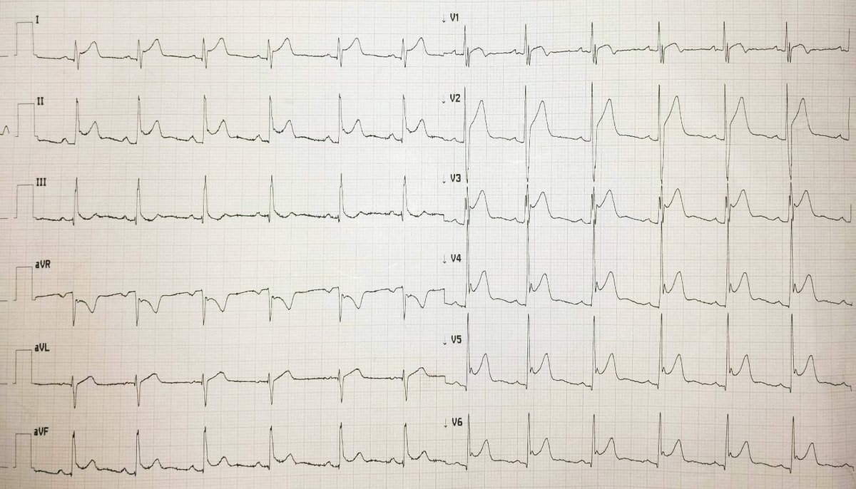 Angel Cueva Parra tweet media