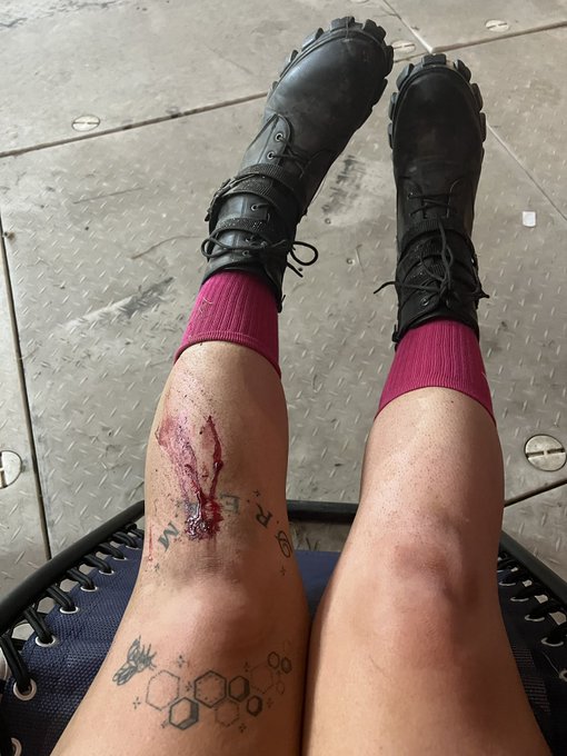 1 pic. The edm community so cute cause yesterday I was walking and ate shit and like 15 people ran to