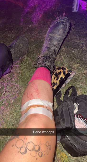 2 pic. The edm community so cute cause yesterday I was walking and ate shit and like 15 people ran to