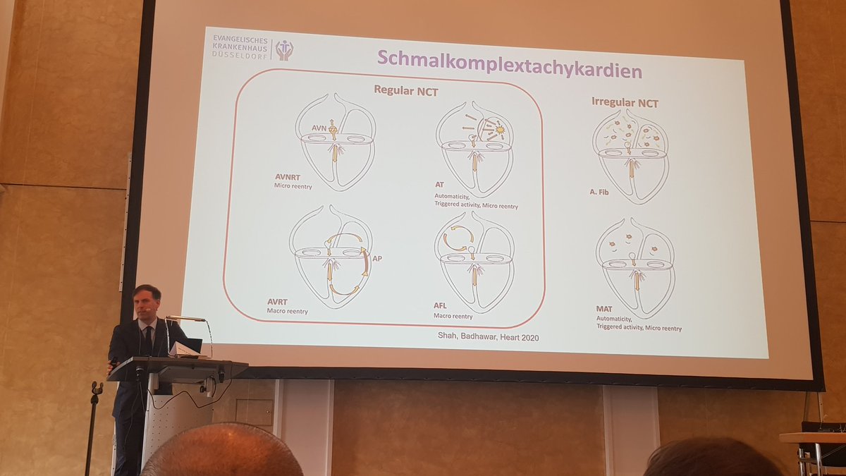 SamerMatar88's tweet photo. Im 3. Vortrag hören wir von Prof. @C_Meyer_MD aus der EVK-Düsseldorf über eine systematische Vorgehensweise bei der Auswertung und Diagnostik schmalkomplexer Tachykardien

#MGEKG
#MönchengladbacherEKGRefrescher https://t.co/DmFlyckgKg