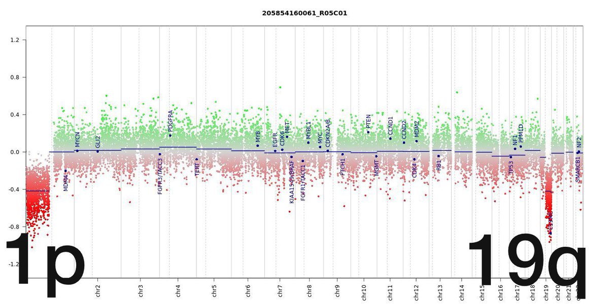 Yes guys! This is an Oligodendroglioma, IDH-mutant and 1p/19q codeleted. The CNV plot shows the codeletion. The chromosomes are in the X axis. The “zero” in the Y axis represents a balanced genome. Look at 1p and 19q, everything is going down!

#neuropath #PathTwitter