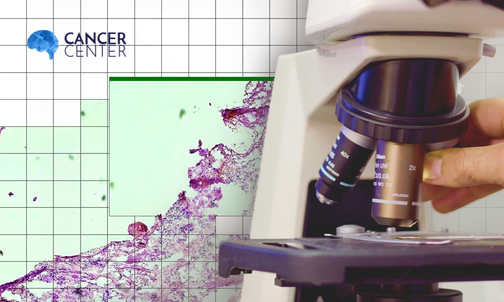 CancerCenterAi's tweet photo. Read the article describing the most important features of the PathoCam application - a software for scanning specimens (by sticking images) viewed under a microscope. https://t.co/CqMjJ1mFhs   #KlasterLifeScienceKrakow https://t.co/zQkj66NC1y