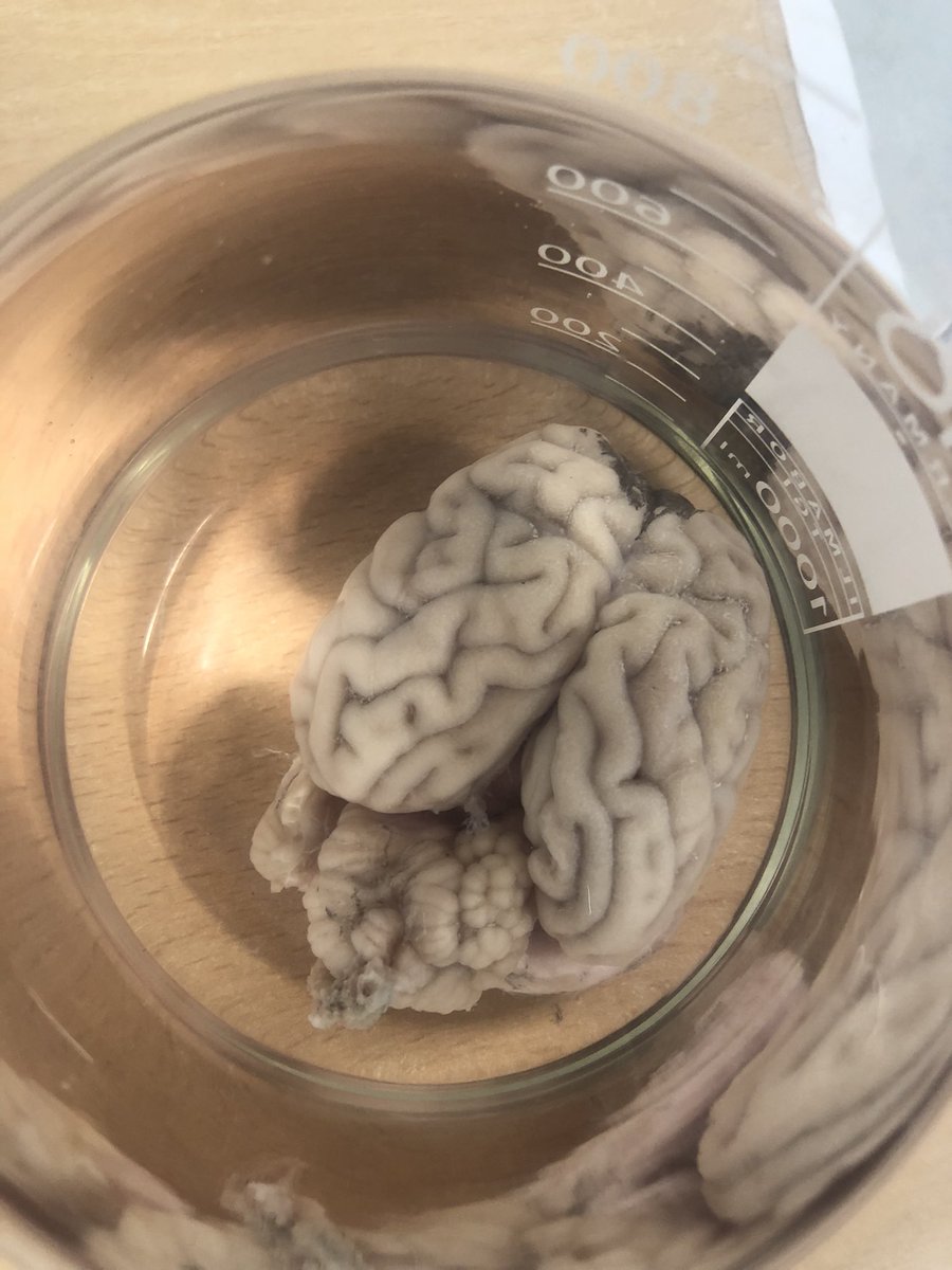 Psych_Grange's tweet photo. We hope our visitors enjoyed learning about the brain today over in Psychology 🧠 @Grange_Cheshire https://t.co/AWKaKsf7Zk