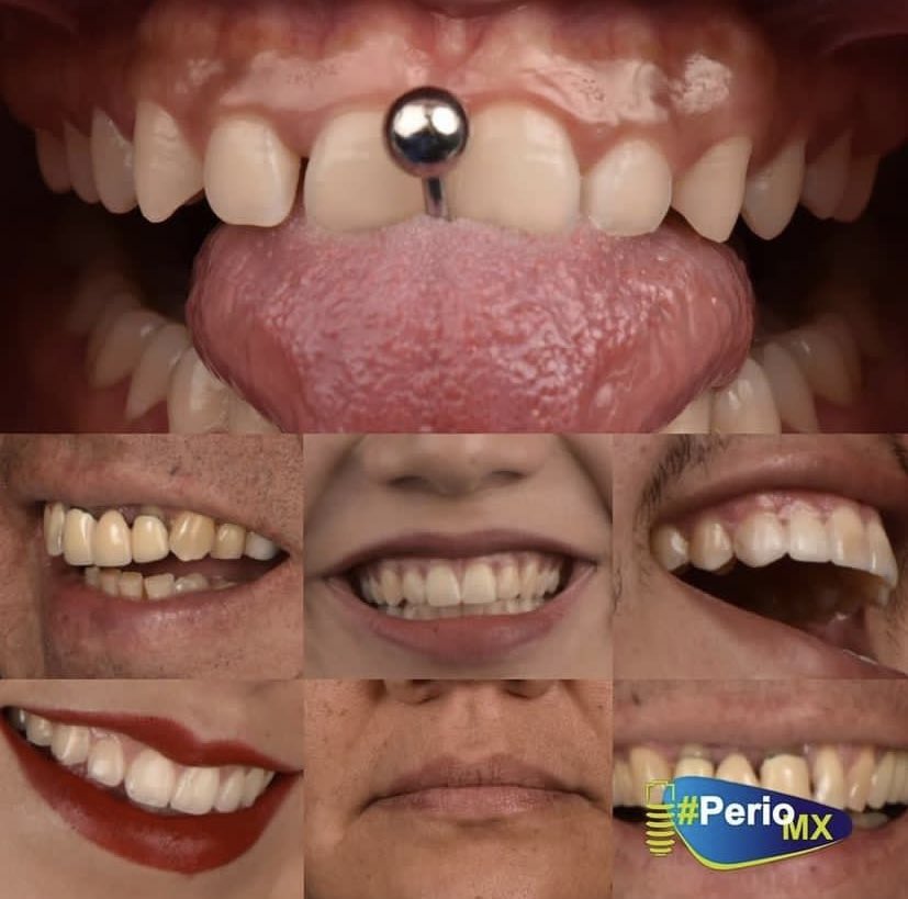 PerioMX's tweet photo. El mejor accesorio que puedes llevar es TU SONRISA 😁

Cuida tu salud bucal 🦷🪥

⭐️EXCELENTE FIN DE SEMANA ⭐️

#periomxacademy #perioGO #perioMX #Periotalks #dentista #odontologia #dentist #online #periodontology #periodoncia #protesisdental #cirugia #dentistlife #prosto https://t.co/EpPyi7h2sX