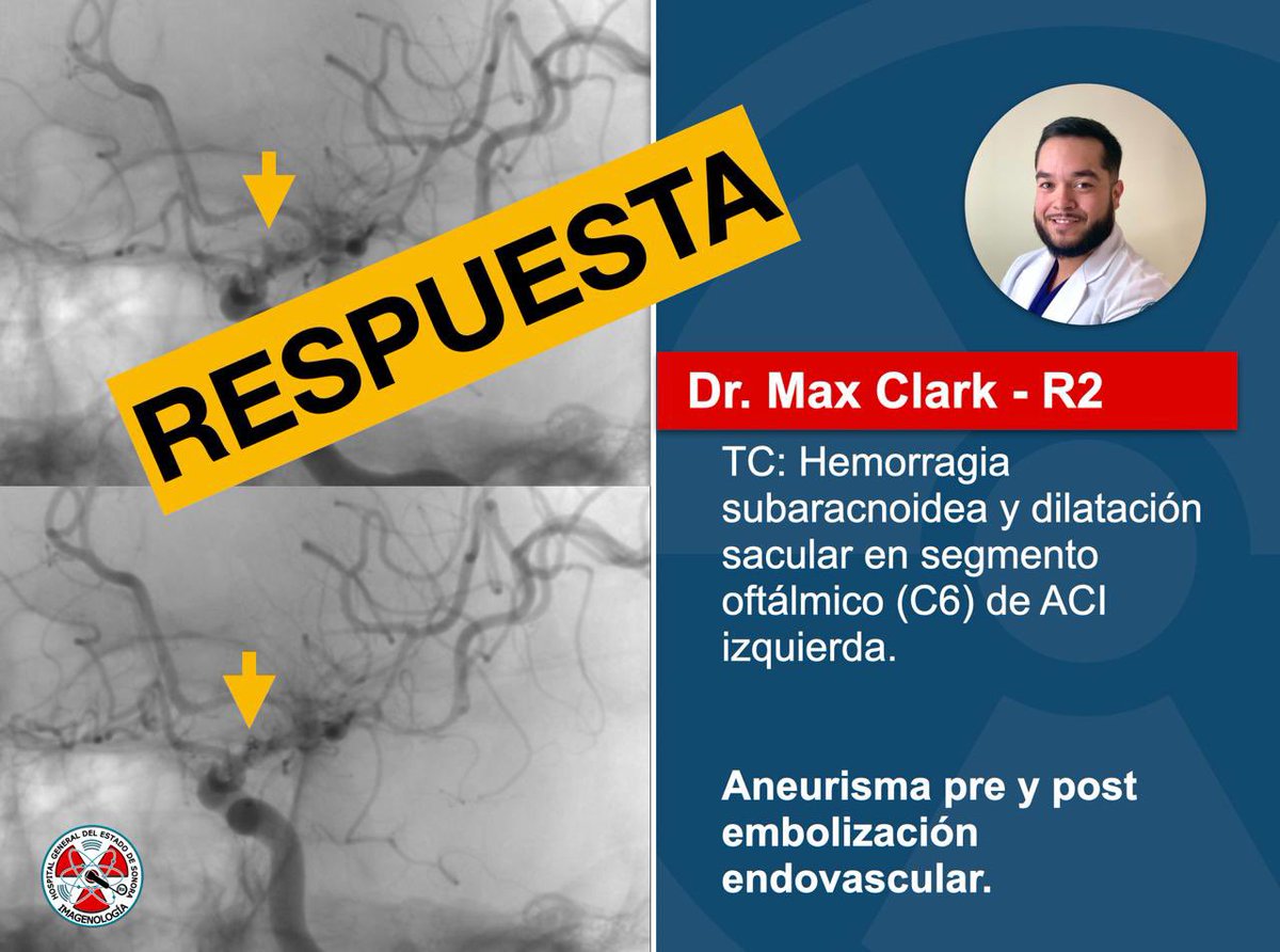 Se presenta respuesta del caso semanal. #radres #radiology #neurology <a href="/maxclarka/">Max Clark</a>