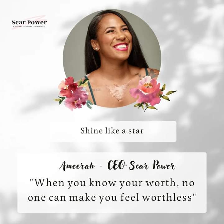 scarpowerco's tweet photo. Know your worth.
Don't let others pull you down.
All people will never be happy with you. What matters most is that you’re happy with yourself. Just do what makes you #happy.
Visit https://t.co/xQm1g2HpbE
#quote #Saturday #knowyourworth #womenempowerment #scarpower https://t.co/U73HYj6Tut