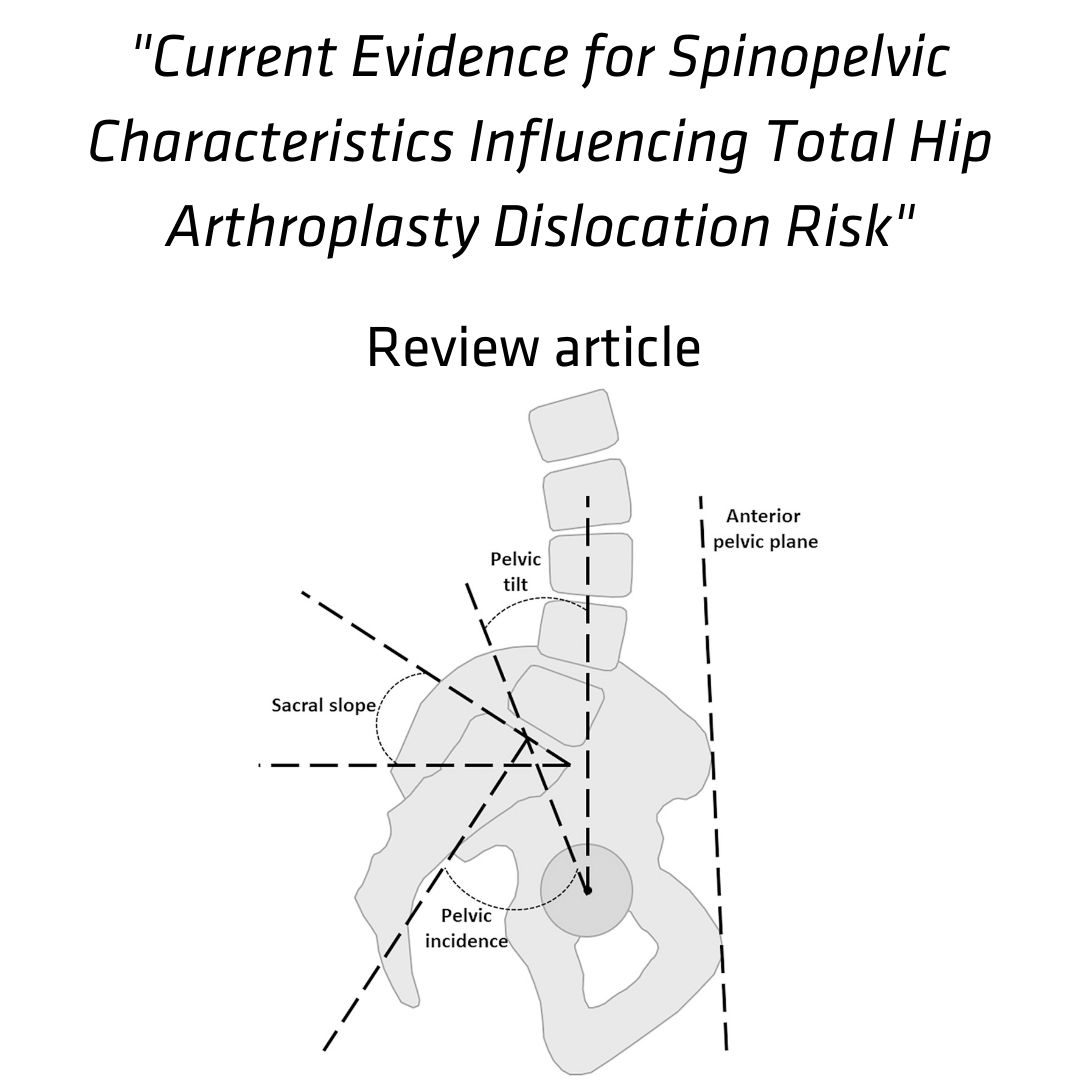 Read our latest article here: bit.ly/3qZeMtK

#surgeon #jbjs #resident #surgery #orthoresidents #orthotwitter #orthopaedics #orthopedic #journal #ortho #spine #hip