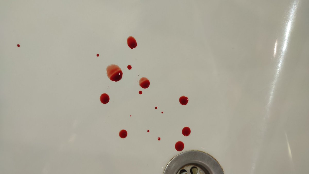 aancheto's tweet photo. #shtwt #catscratches #s3lfharm #selfharm https://t.co/uJ5wtK8xRz