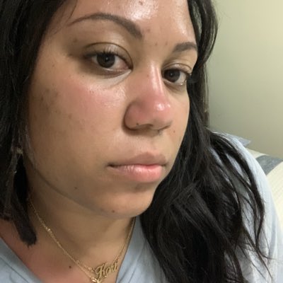 koricometh's tweet image. #NewProfilePicmy sunburned face 😅