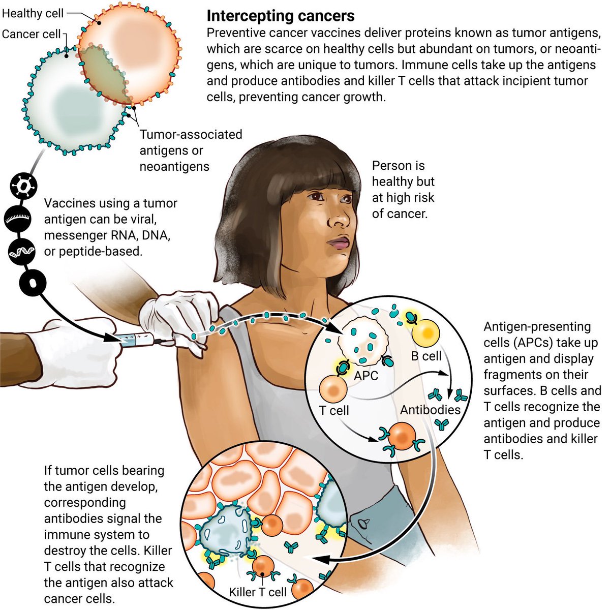 The Innovation | Medicine (@Innov_Medicine) on Twitter photo 2022-09-24 18:47:53 A new generation of cancer-preventing vaccines could wipe out tumors before they form.
From @ScienceMagazine
Learn more on #WorldCancerResearchDay: fcld.ly/nr825rr A new generation of cancer-preventing vaccines could wipe out tumors before they form.
From @ScienceMagazine
Learn more on #WorldCancerResearchDay: fcld.ly/nr825rr