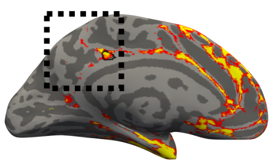 PessoaBrain's tweet photo. Part of the posterior cingulate cortex is part of the fronto-parietal network! A hidden anatomical landmark.
https://t.co/p03g2xanS5 https://t.co/3Hm5uy8t2V