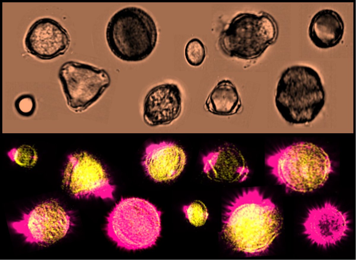 DrAnnPower's tweet photo. #pollen in wildflower #honey captured via #imagingflowcytometry. This lovely wildflower honey is packed with lots of beautiful pollen grains, reflecting its yumtastic qualities!
#bees #beekeeping #research #science #art https://t.co/j4wHfXWQ0I