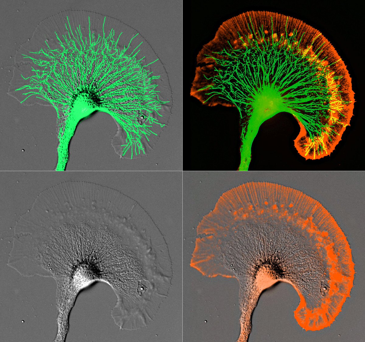 MAG2ART's tweet photo. A neuronal growth cone photographed through a microscope. DIC, actin filaments and microtubules are shown. One of my many @NikonSmallWorld rejects from the 2000’s. #NSWRejects https://t.co/h1szOdfcGc