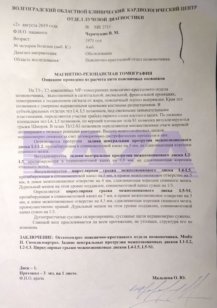RALee85's tweet photo. A 51-year old in Volgograd was mobilized even though he doesn’t have combat experience, is deaf in one ear, has poor eyesight, and herniated discs. Despite this, he was sent to training without a medical examination. 
https://t.co/EqKcOcd7Za https://t.co/HPztLa81vj