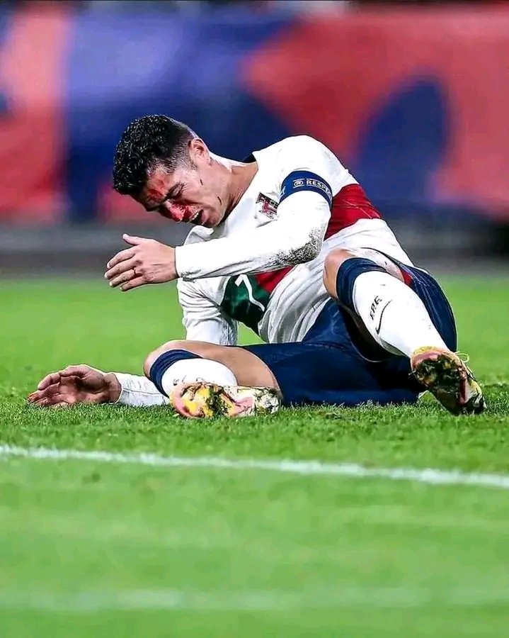 Le dieron sin piedad al bicho