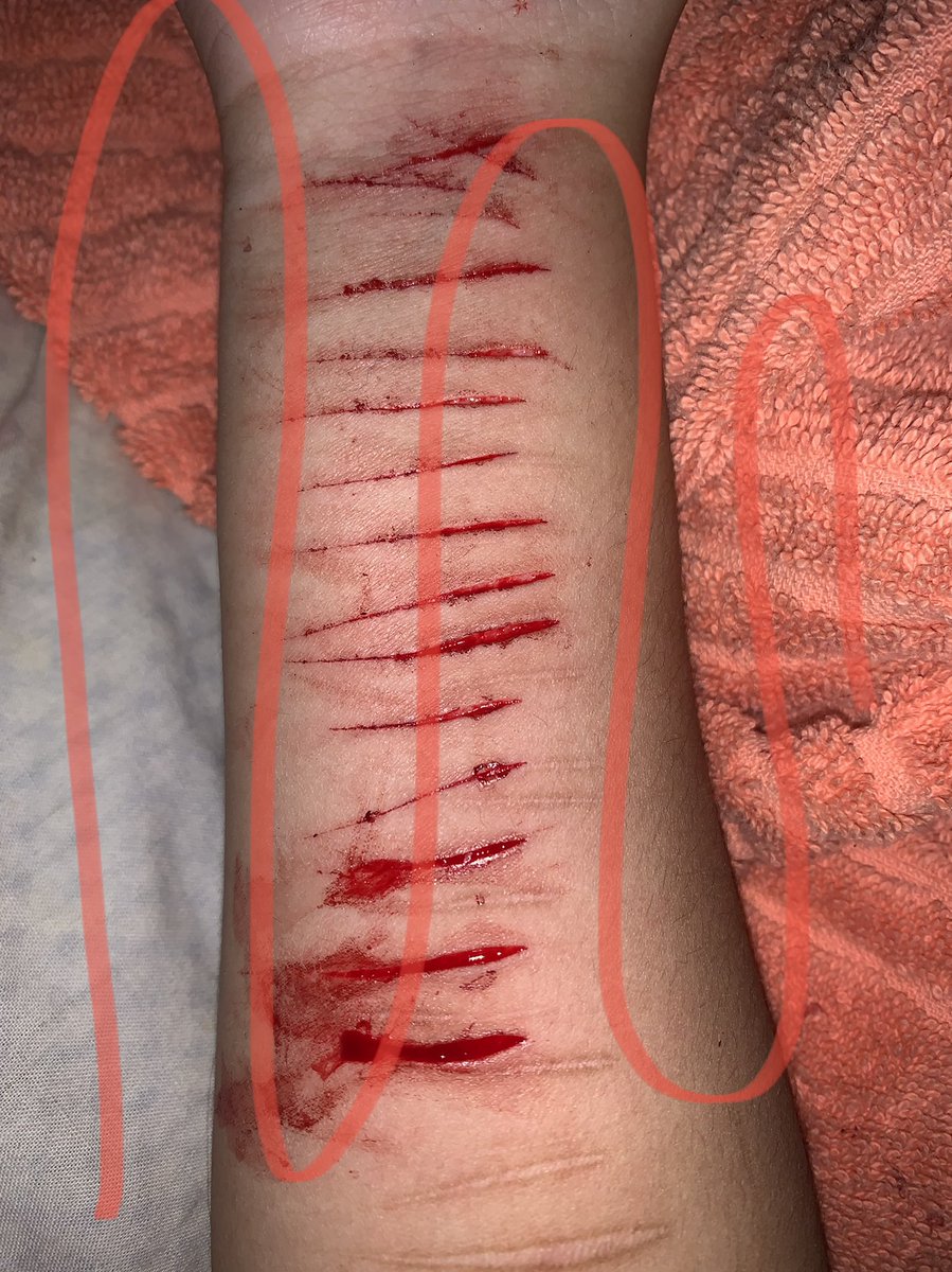 emostray's tweet photo. (FAKE NOT REAL SFX MAKEUP) 
pretty.. but they could be deeper :)

-
shtwt https://t.co/Yqlf87qp1p