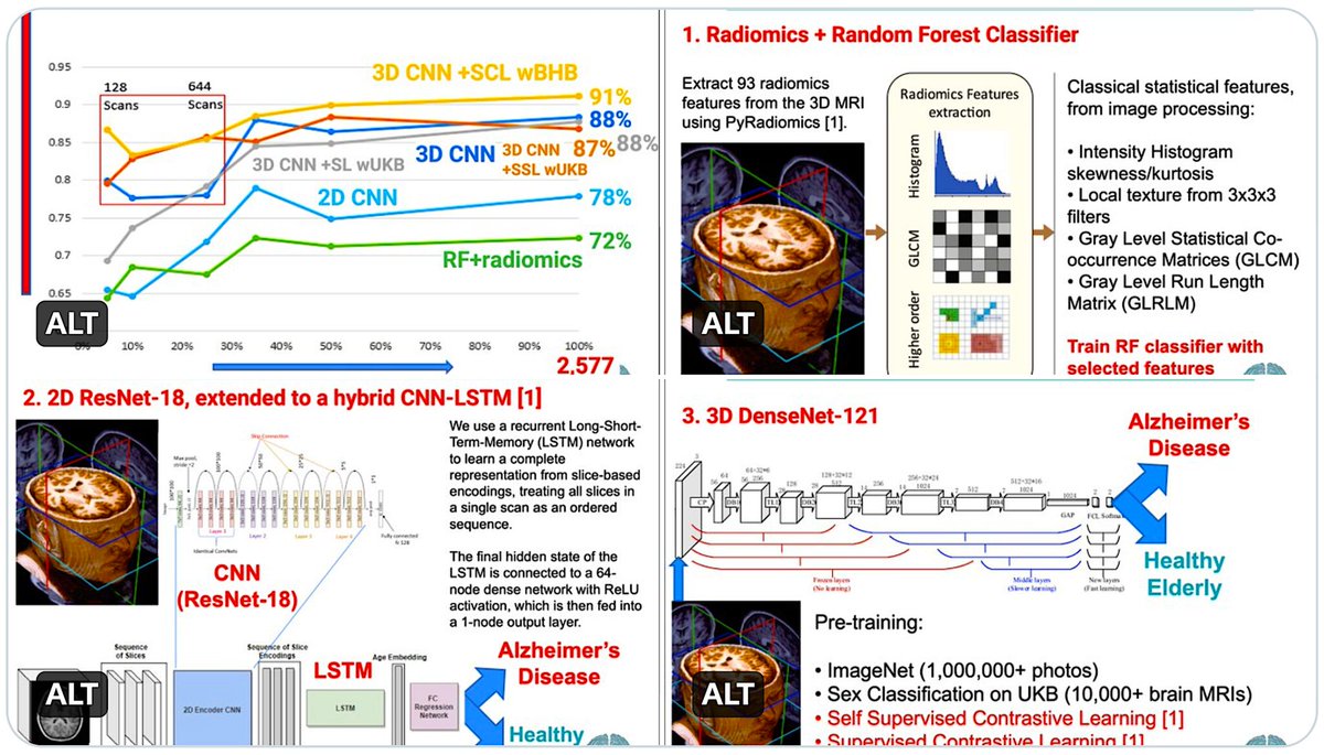 we CAN now YOU DETECT #Alzheimer's disease with #AI + brain MRI scans. Superb new head-to-head study, just out, by <a href="/NDhinagar/">Nikhil Dhinagar</a>  + Enigma team Check it out here,  lnkd.in/g9SgXTvi
congrats <a href="/PTenigma/">Paul Thompson</a> and the team.