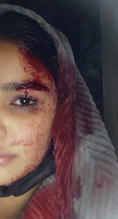 Joana_Taimasi's tweet photo. دختر ایران
This is the face of my country Iran, wounded but defiant. Beaten but unbowed.
The woman who sent this video is 21 year old and says; the security forces attacked me tonight for the crime of protesting.But I won’t give up.I am #MahsaAmini 
#مهسا_امینی
#اشنویه 
#OpIran https://t.co/iPfugwQiSE
