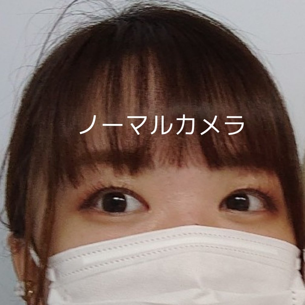 m_oilqq's tweet photo. 眉下切開と目頭切開　経過
1年💮
もうほぼ変化ないのでメイクした状態のビフォアフを。
傷はもちろんコンシーラーなしです。
整形したこと記憶にないぐらい何も気にならない🤙
素カメラで友達と写真撮ることが増えました。
もう経過写真は載せないと思いますが何か質問とかあれば質問箱にどうぞ🙏🏻 https://t.co/qRLbZwjqD1