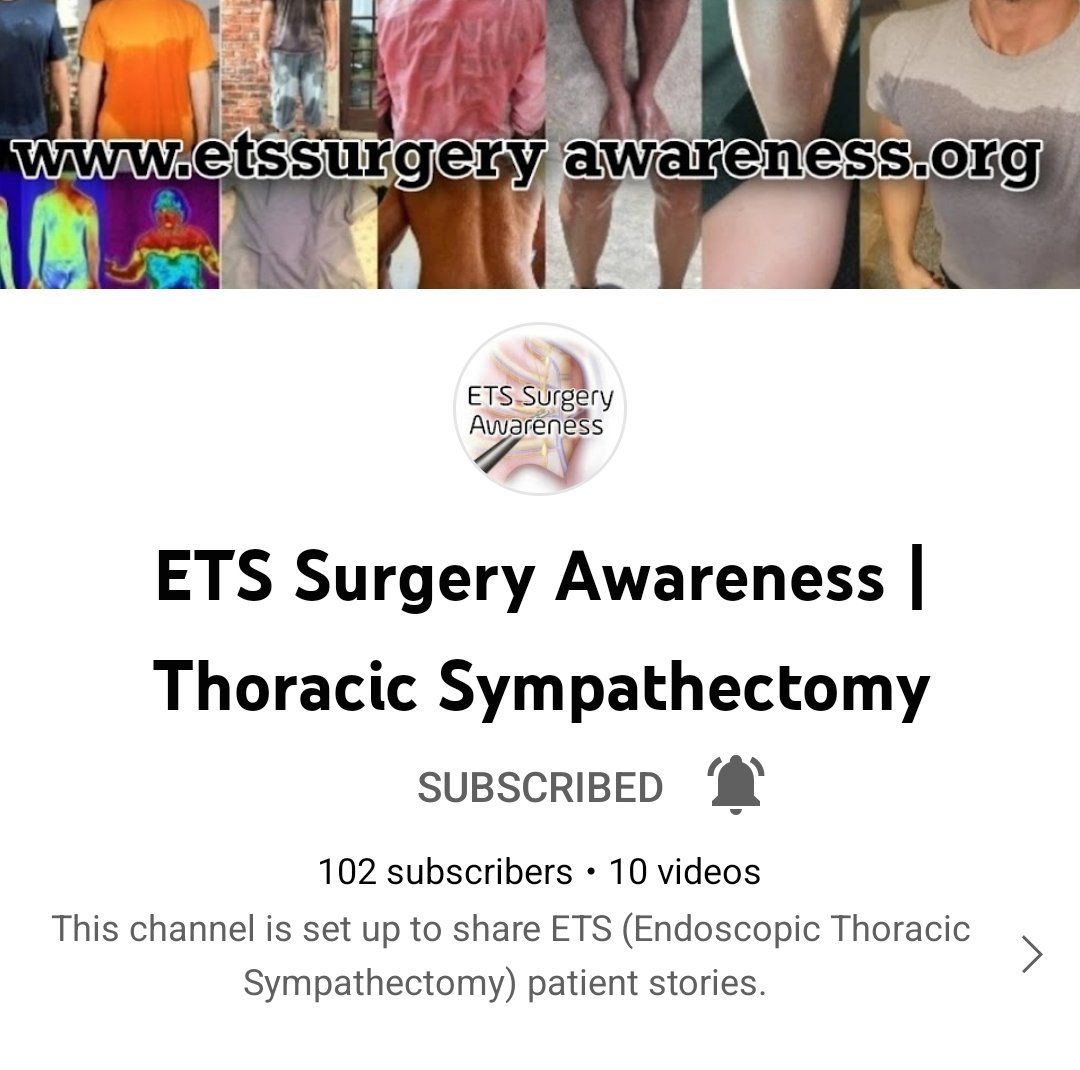 EtsSurgery's tweet photo. #ets patients are now sharing their experiences on #YouTube

Please come and learn from the patients &amp; support us!

https://t.co/KTnYguF9Vp

#hyperhidrosis #etssurgery #blushing #sweatypalms #swearing #Neurology #MedTwitter #neurophysiology #thoracic #sympathectomy @WeKnowSweat https://t.co/jcSsB65R4G
