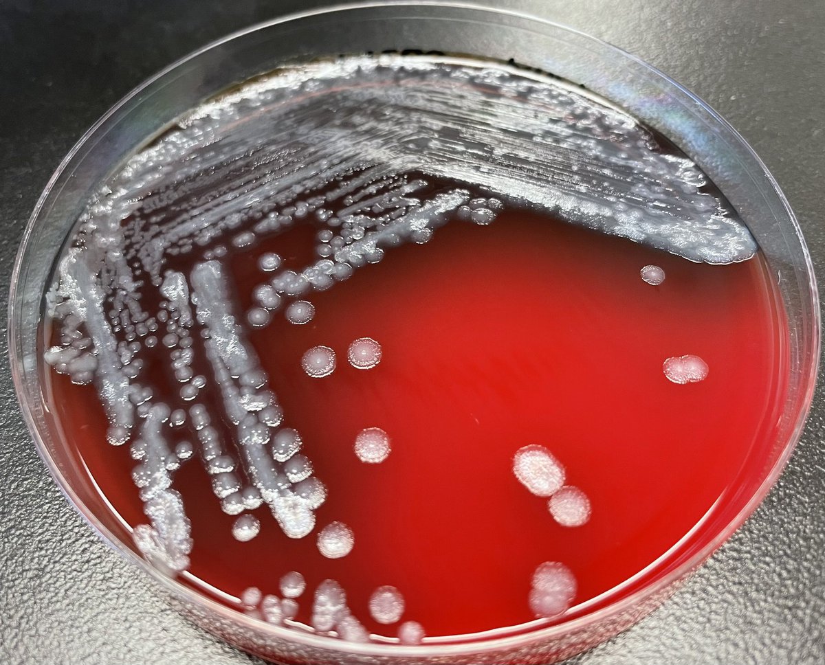 DraWataru's tweet photo. Pseudomonas aeruginosa collection... https://t.co/XJi24LeWAr