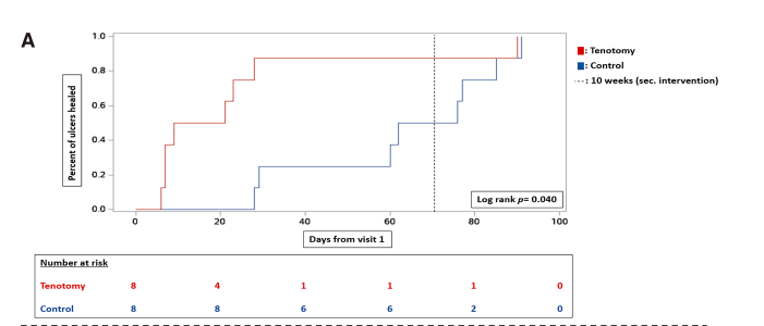 See the RCT demonstrating the benefit of flexor Tendon Tenotomy Treatment of the Diabetic Foot for healing of ulcer and prevention: diabetesjournals.org/care/article-a… R <a href="/Stenodiabetes/">Steno Diabetes Center Copenhagen</a>