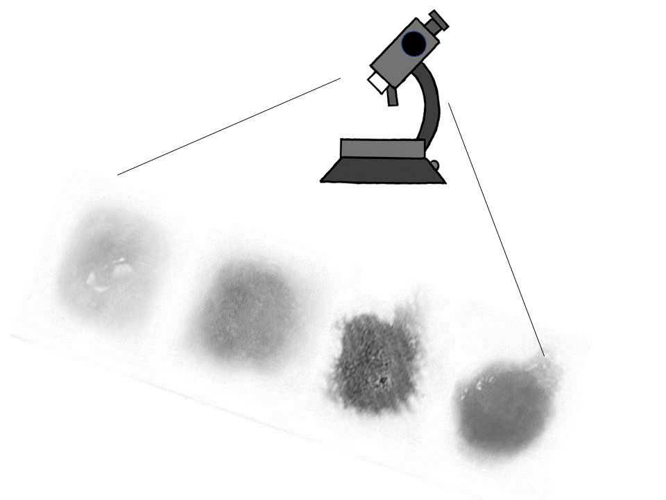 AmitGefen's tweet photo. #Exudate content studies allow to replicate #wound conditions in the #laboratory, as described in our (@GefenLab &amp; Dr. Breda Cullen) newly published #OpenAccess @IntWoundJournal article: https://t.co/I1g9JkN27m

@WOCNSociety @EWMAwound @NSWOC @WoundSource @WoundHeal @molnlyckehc https://t.co/O65Z9y3Bkk