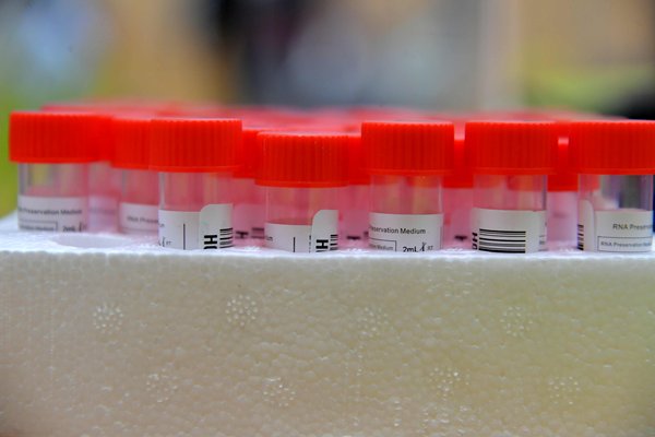 newsgovhk's tweet image. The Govt completes a joint enforcement operation at Block 12 of Richland Gardens in Kowloon Bay, which was earlier included in a #CompulsoryTesting notice #COVID19 news.gov.hk/eng/2022/09/20…