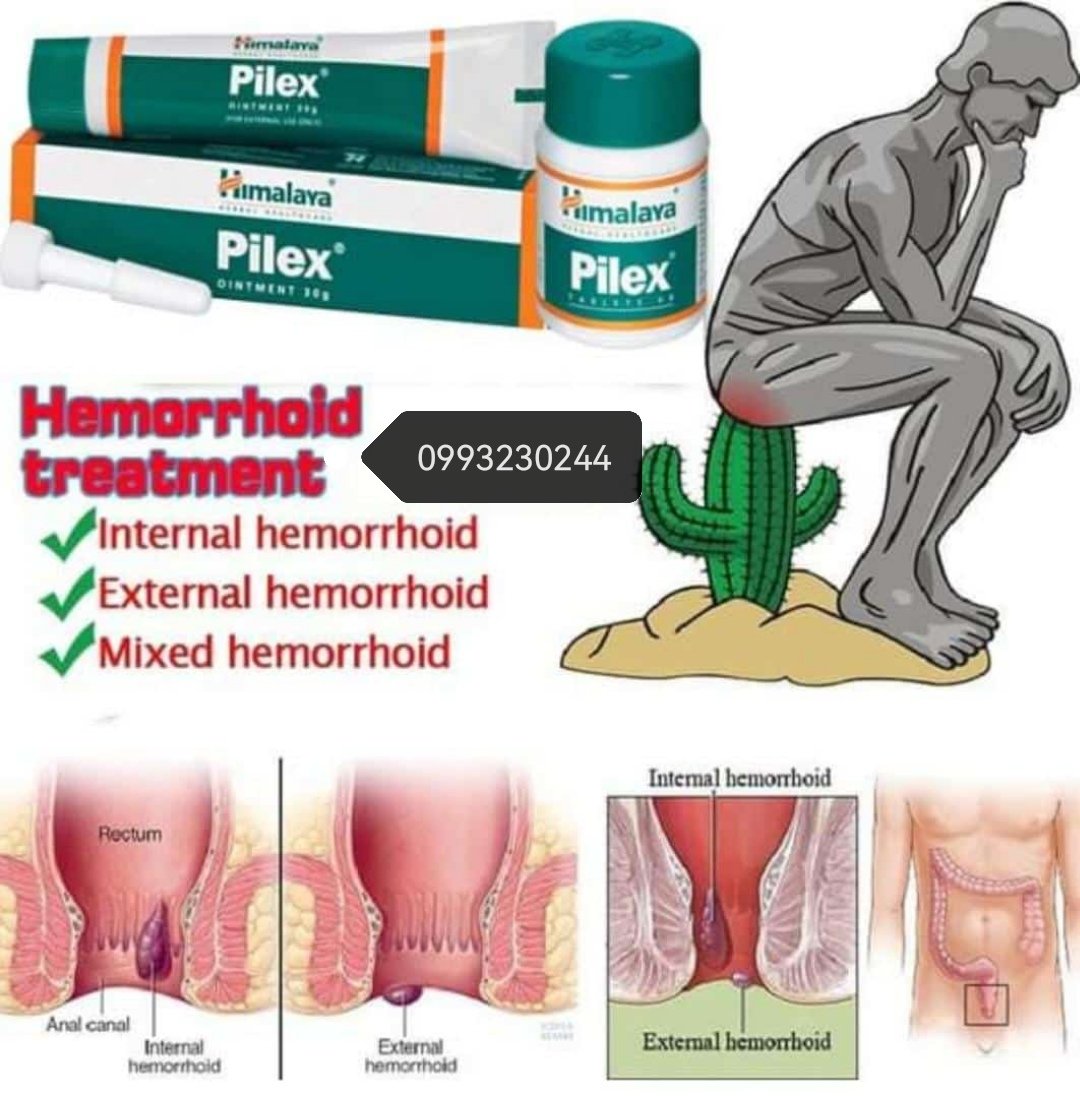 HarrisOs0's tweet photo. Pilex available in stock only K13000, What'sApp on 0884282710 or call 0995266608 https://t.co/1sbEVUTk63