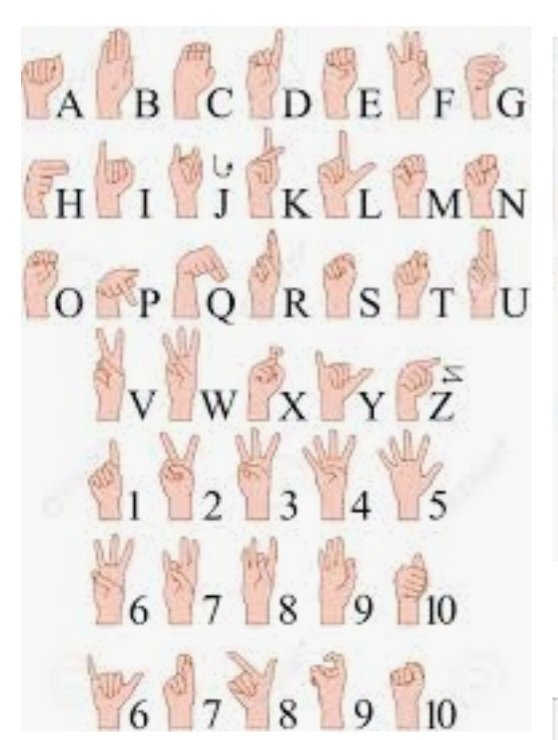 alde_gara's tweet photo. #Nazioarteko #pertsona #gorrenEGUNA
#DiaMundialDeLasPersonasSORDAS
Cuando en San Mames oímos una alineación- un cambio- unas instrucciones. Cuando se da una RdP. Cuando sale un jugador a hablar. En definitiva cuando se transmite Información. Hay Socios/aficionados MARGINADOS https://t.co/BQszorTb38