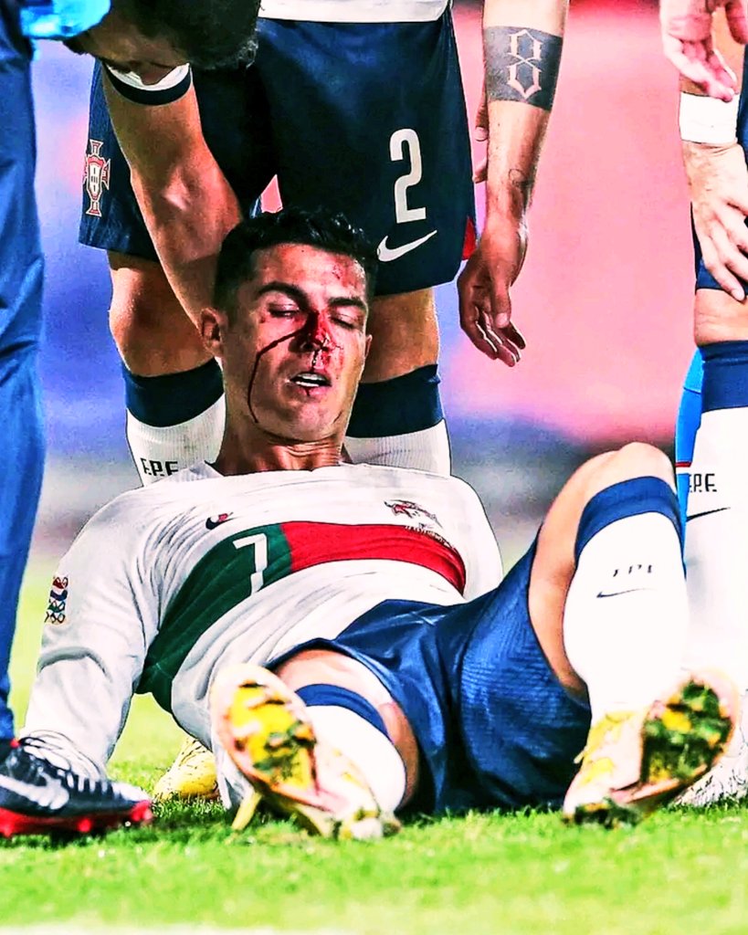 20LAMA7's tweet photo. Ahead of the World Cup right now where everyone wants to play with their legs saved, you still jump on the ball ❤
You have played the match until the end. Yes, this is Cristiano Ronaldo. The love is too much ❤️✨️
Cristiano Ronaldo 🌞⚡️ https://t.co/uqv7sNtwm5