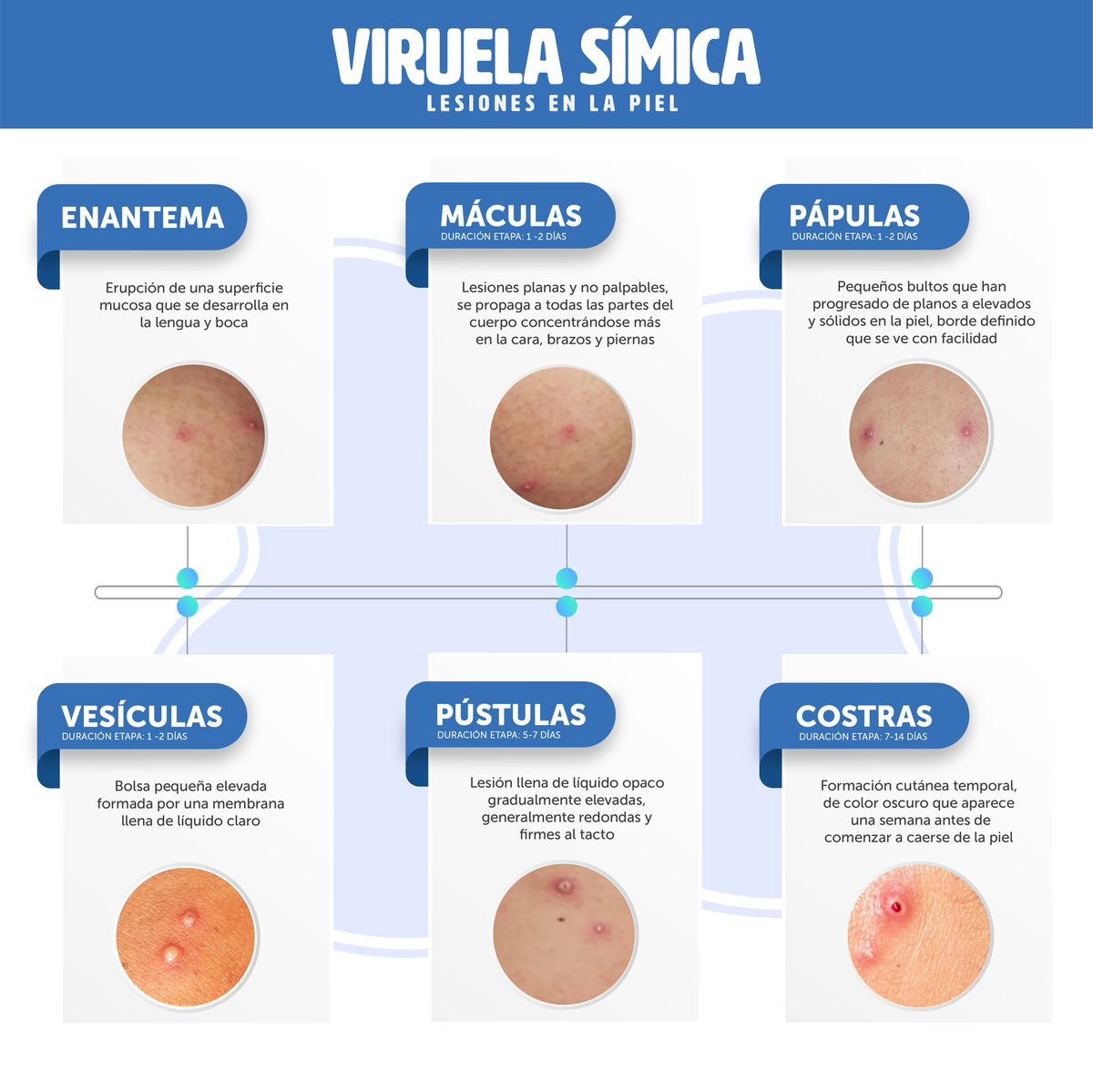 FranAlabi's tweet photo. Recordamos a la población que, ante cualquier sospecha, puede llamar al @SEM132_SV, opción 4.

Comparto, nuevamente, el desarrollo de las lesiones de la viruela símica. https://t.co/oiyvuDAtE1