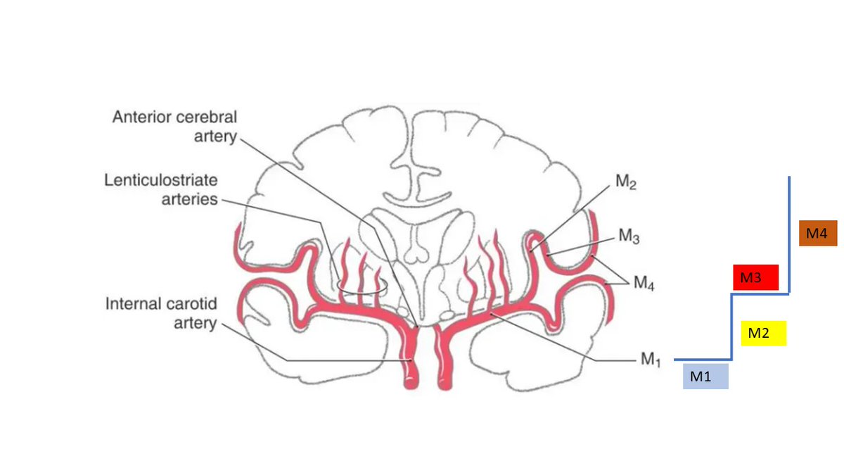 bobvarkey's tweet image. Clinical pearl; An easy way to remember the MCA segments. It looks like a staircase. The horizontal parts are M1 &amp;amp; M3, the vertical parts are M2 &amp;amp; M4