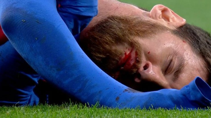 ShuanDee7's tweet photo. There's a huge difference between doing it for the fans(Media) and doing it because everyone needs you and you have too.. 🥺

#Messi𓃵 makes me emotional sometimes 🤞🏽 https://t.co/6r241CVXGO