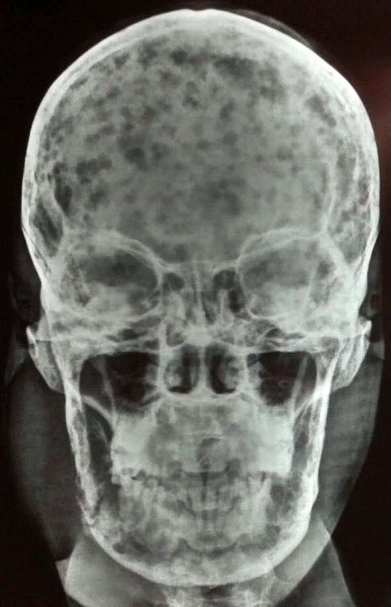 Journal of Brown Hospital Medicine tweet media