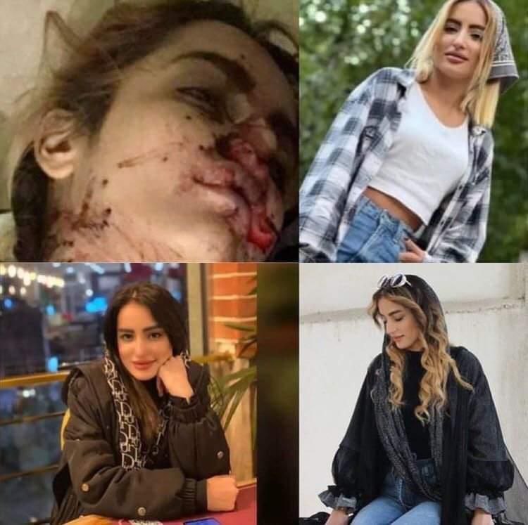peymooNFT's tweet photo. A 20-year old girl (#hadisnajafi ) from iran(karaj) was killed with 6 bullets to her heart, head, hands and chest ... another villainy from islamic republic 
#MahsaAmini 
#hadisnajafi https://t.co/MA5VeEWVvY