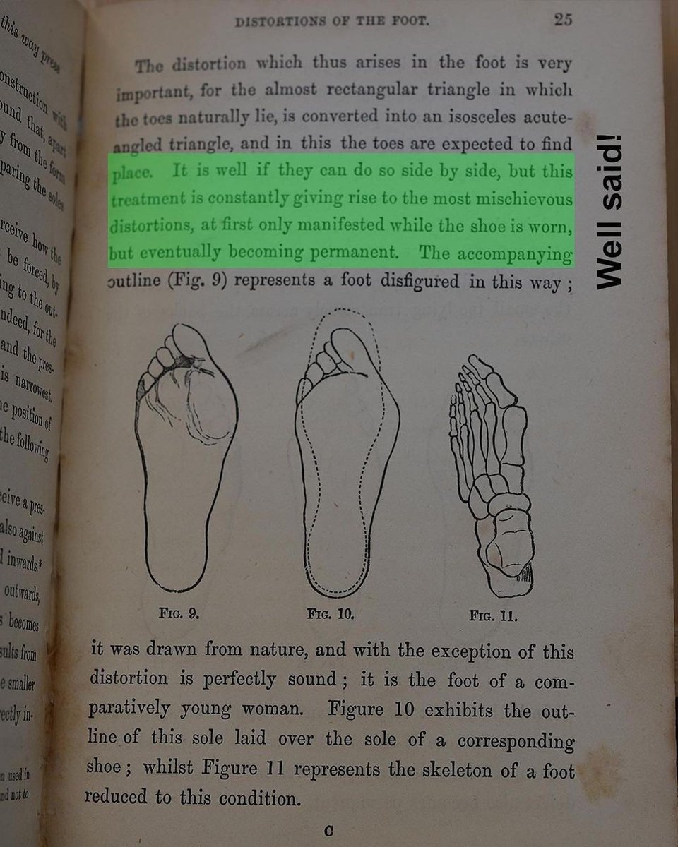 feelgrounds's tweet photo. “Why the shoe pinches, published 1868. This incredible book was published to help educate the public over 150 years ago. We have highlighted some of the pages surrounding this “famous” illustration which we have attempted to bring back to life.” - @myfootfunction #feelgrounds https://t.co/sRod5QwSEt