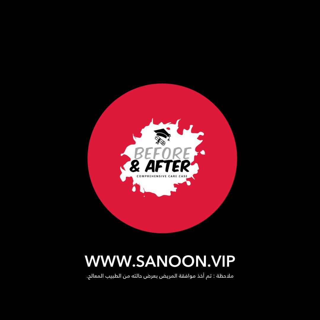 sanoonvip's tweet photo. ⭐🦷
مشاركة د. مريم أسعد من جامعة اوروك بالعراق👏 
TW : @Maryamasaad15
❤️ 💬  🔁 
#طب_الاسنان https://t.co/41bbuM8eGM