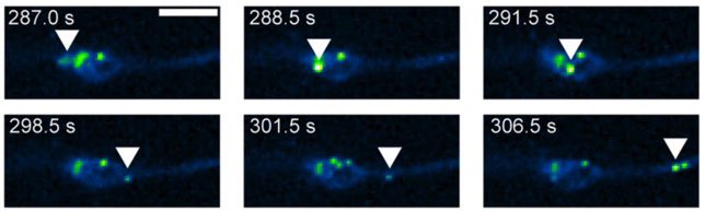 vicpozo's tweet photo. Our last work exploring real-time changes in the axon during a mechanical injury https://t.co/kGd1rYXjXN. In @GBStokin lab at @FNUSA_ICRC  with @monica_feole, @Valentinko_DF , @pratikshabhat among others. https://t.co/D6gBhFTWf4